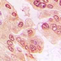 Anti-FOXO1 (Phospho-S329) Antibody