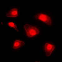 Anti-FOXO1 (Phospho-S329) Antibody