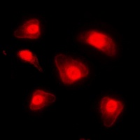 FOXO1 (Phospho-S329) antibody