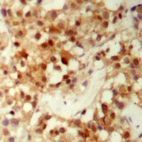 Anti-FOXO3 (Phospho-S253) Antibody