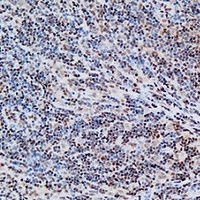 FOXP1 antibody