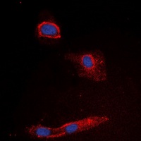 Anti-Granzyme K Antibody