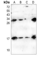 Anti-IL-6 Antibody