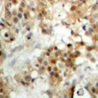 IRF3 antibody