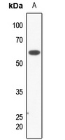 KCNK3 Antibody