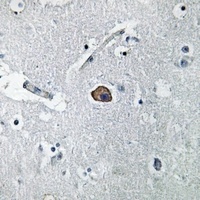 L1CAM antibody