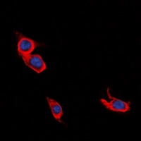 Anti-L1CAM Antibody
