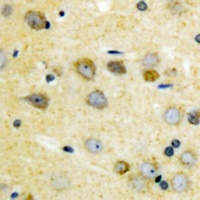 Anti-TAK1 (Phospho-T187) Antibody