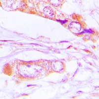 Anti-ERK1/2 (Phospho-T202/Y204) Antibody