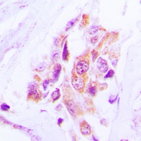 Anti-MARK Antibody