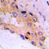 Anti-mTOR (Phospho-S2448) Antibody