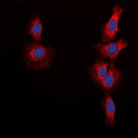 mTOR (Phospho-S2448) antibody