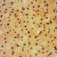 Anti-NT5C1A Antibody