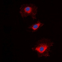 NT5C1A antibody