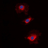 Anti-NT5C1A Antibody