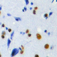 Anti-POLR3H Antibody