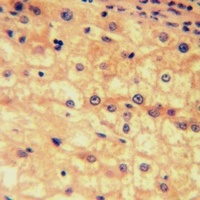 Anti-EP2 Antibody
