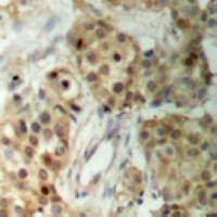 MSK1 Antibody