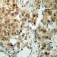 MSK1 antibody