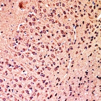 Anti-HSN1 Antibody