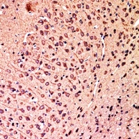 HSN1 antibody