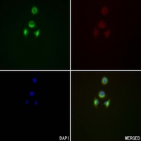 Anti-HSN1 Antibody
