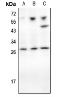 TIMP1 Rabbit Polyclonal Antibody