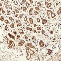 Anti-TIMP1 Antibody