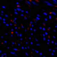 Anti-TIMP1 Antibody