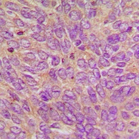 Anti-GCP6 Antibody