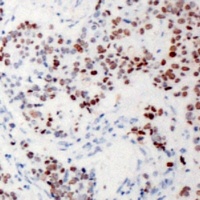 Anti-XRN2 Antibody