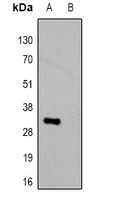 HSV-tag Antibody