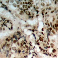 Anti-PTEN (Phospho-S380/T382/T383) Antibody