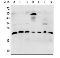 p21 Antibody