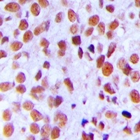 Anti-Ku80 (Phospho-T714) Antibody
