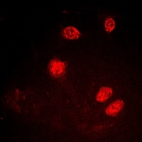 Anti-Ku80 (Phospho-T714) Antibody
