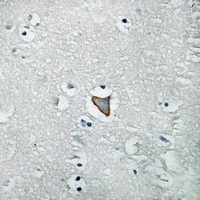 Anti-HER3 (Phospho-Y1222) Antibody