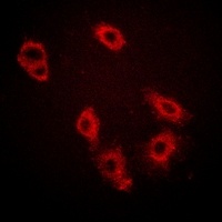Anti-HER3 (Phospho-Y1222) Antibody