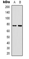 Rabphilin 3A Rabbit Polyclonal Antibody
