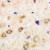 Anti-Rabphilin 3A Antibody