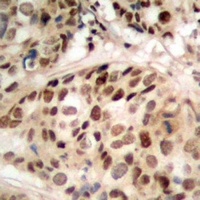 PHF1 antibody