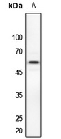 Dyskerin Antibody