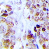 Anti-Dyskerin Antibody