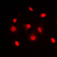 Anti-Dyskerin Antibody