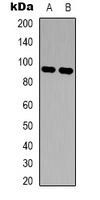 c-FER Antibody
