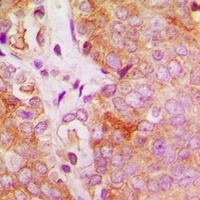 Anti-c-FER Antibody
