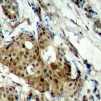 Anti-CDK11B Antibody