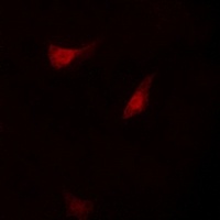 Anti-S6K1 Antibody