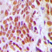 Anti-HMGB2 Antibody