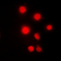 Anti-HMGB2 Antibody